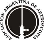 Artroscopia