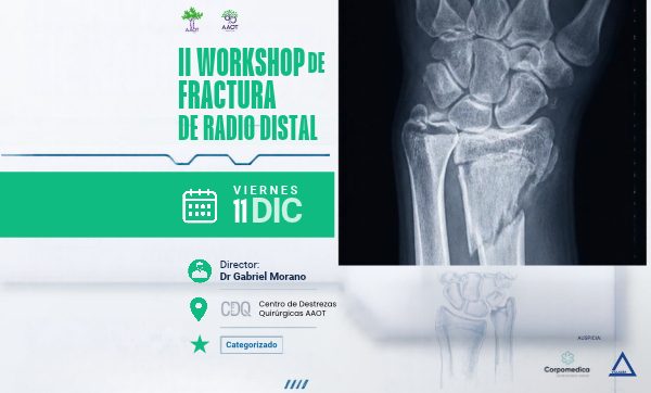 Workshop Fractura de Radio Distal Post (600 x 362 px)